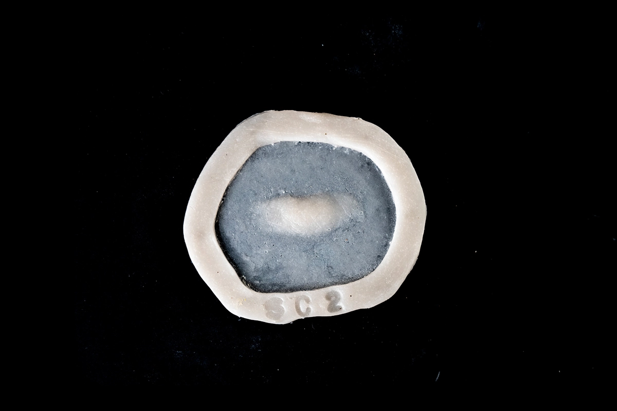 Référence SC2 Prothèse gel de silicone générique Cicatrice polyvalente.