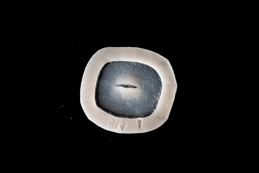 Référence BN1 Prothèse gel de silicone générique Nez cassé.