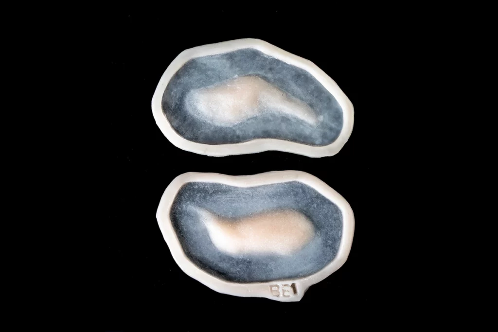 Référence BE1 Prothèse gel de silicone générique Oeil au beurre noir.